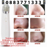 НЕМСКИ УРЕД ЗА ПОЧИСТВАНЕ НА ЛИЦЕ от черни точки XN 8030 + ЛЕД ФЕНЕР