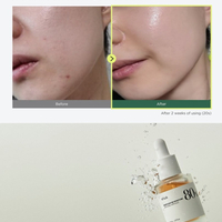 ANUA Heartleaf 80% soothing ampoule