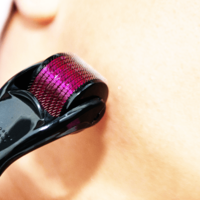Aparat masaj facial Professional Neo™ Derma Roller Plus pentru regenerarea pielii si reducerea ridurilor si cicatricilor, 540 ace din titan