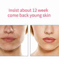 Aparat Profesional tratament facial si intinerirea pielii 5 in 1, Neo™ Skin®, Mezoterapie, LED, Lifting, Anti Rid, vibratii EMS, Microcurent, Masaj facial, Roz