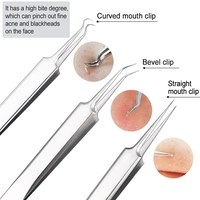 Set 6 pensete pentru extractie puncte negre, comedoane, acnee, ustensile cosmetice din inox, metalic, Neo™ Premium®