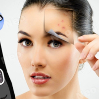 Aparat Profesional de ingrijire faciala prin Rejuvenare cu Fotoni 5 in 1 Neo Photon™, pentru intinerirea pielii, efect anti-rid, tratament Electroporare, RF lumina LED, inchide porii, elimina acneea, albire, pentru fata/gat, stativ incarcare rapida, Negru
