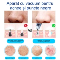 Aparat Vacuum Presure Cleaner,curatare ten,acnee,pori,puncte negre