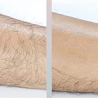 Dispozitiv de Epilare prin Frecare cu cristale, Salestore.ro® pentru indepartarea parului si exfoliere, reutilizabil, fara durere, Roz Cald