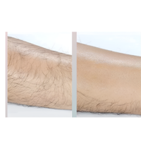 Epilator cu Cristale, pentru Epilarea de Lunga Durata, Albastru, Neo™