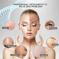 Aparat de curatare faciala cu ultrasunete, Neo™ Skin®, lifting ten, skin scrubber, spatula indepartare puncte negre, hidratare, peeling, Alb