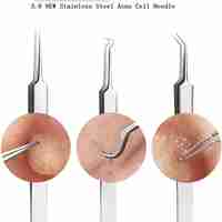 Set 7 pensete pentru extractie puncte negre, comedoane, acnee, ustensile cosmetice din inox, metalic, Neo™ Premium®