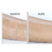 Epilator cu Cristale, pentru Epilarea de Lunga Durata, Roz, Neo™
