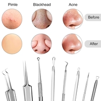 Set 8 pensete pentru extractie puncte negre, comedoane, acnee, ustensile cosmetice din inox, metalic, Neo™ Premium®