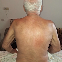 Masaj terapeutic și chiropractică (îndreptarea oaselor fără durere) (5+1)