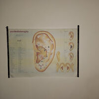 Auricoloterapie - presopunctură la lobul urechii (9+1)