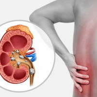 ФитоКомплекс 'Лечение почек и мочекаменной болезни'