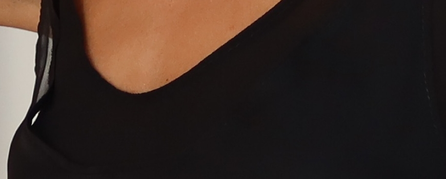 Tops