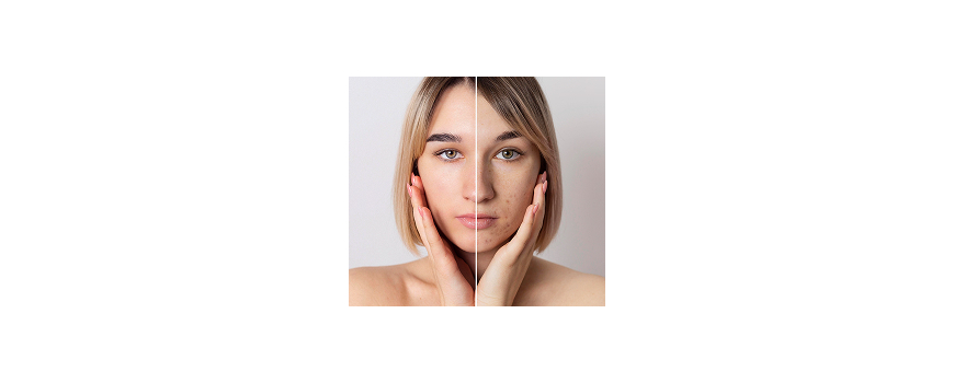 Estetică și Îngrijirea Pielii