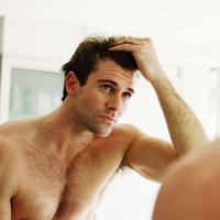 Косопад при мъже: основни причини и как да го спреш навреме