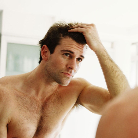 Косопад при мъже: основни причини и как да го спреш навреме