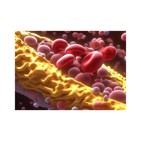 Висок холестерол