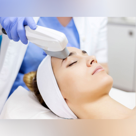 HIFU лифтинг - зона Чело