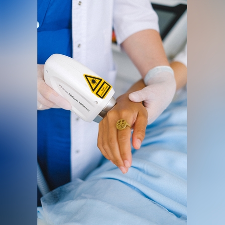 Лазерна епилация зона Длани /Жени/