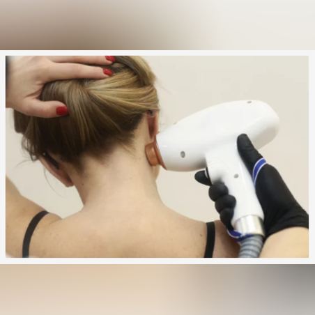 Лазерна епилация зона Врат /Жени/