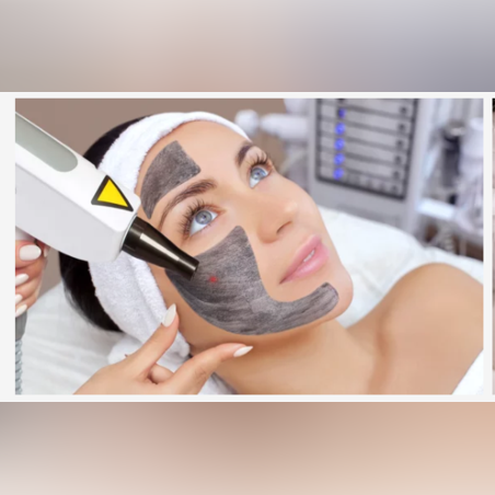 Карбонов (Холивудски) пилинг - Шия