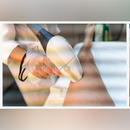 Лазерна епилация зона Бедра /Мъже/