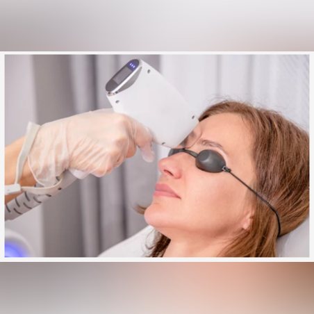 Лазерна епилация зона Вежди /Жени/