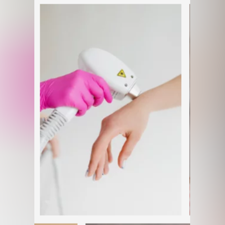 Лазерна епилация зона Китки /Жени/