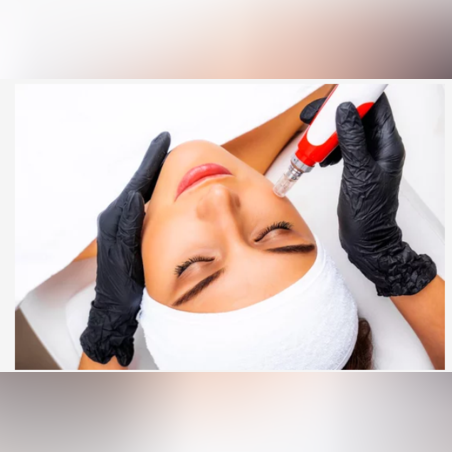 Микро мезотерапия - Цяло лице