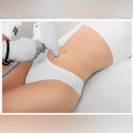 Лазерна епилация зона Коремна линия /Жени/