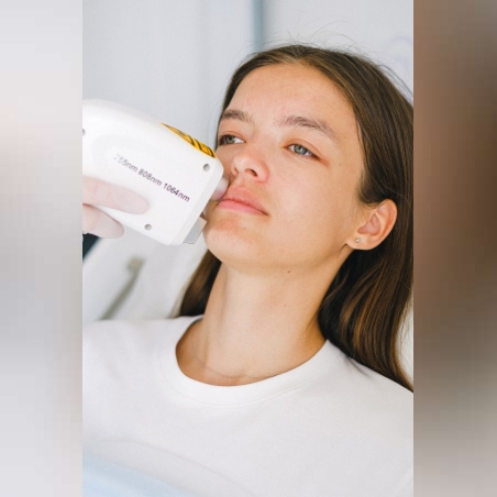 Лазерна епилация зона Горна устна /Жени/