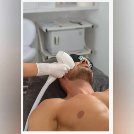 Лазерна епилация зона Бузи /Мъже/