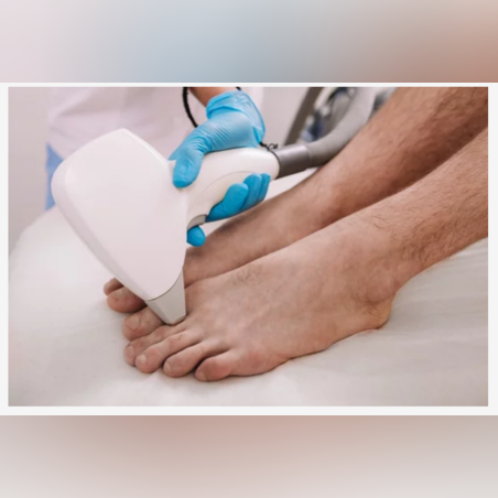 Лазерна епилация зона Пръсти ръце и крака /Мъже/