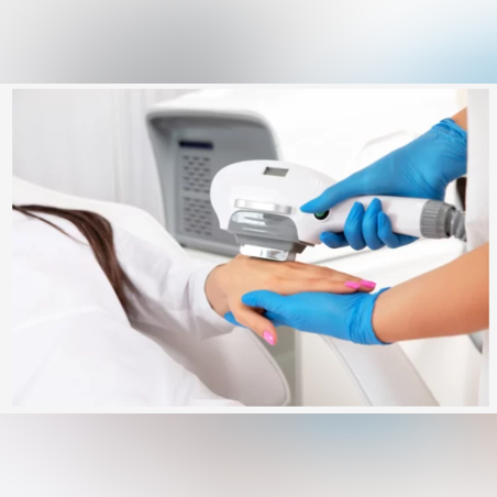 IPL Терапия - Длани