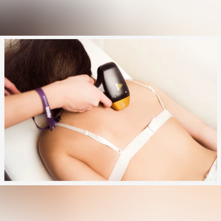Лазерна епилация зона Цял гръб /Жени/