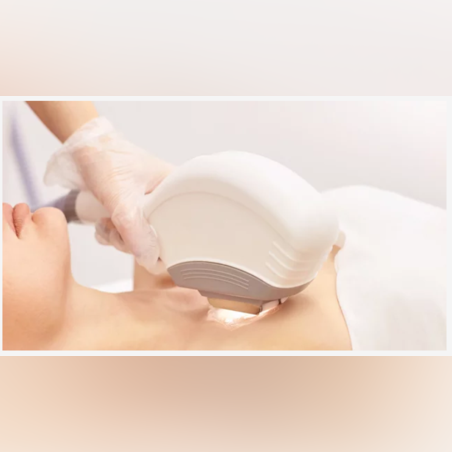 IPL Терапия - Деколте