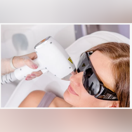 Лазерна епилация зона Скули /Жени/