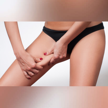 HIFU лифтинг - зона Вътрешно бедро