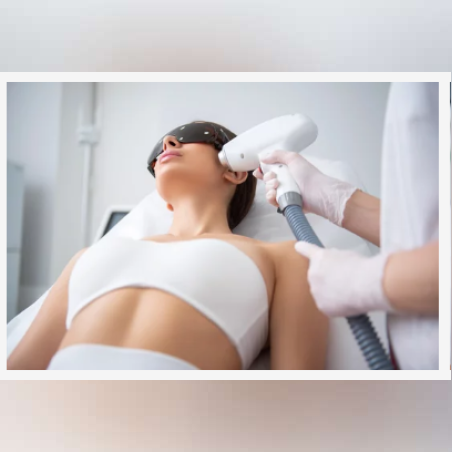 Лазерна епилация зона Бузи /Жени/