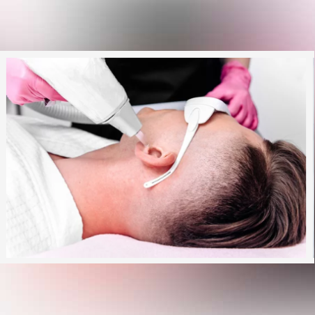 Лазерна епилация зона Уши /Мъже/