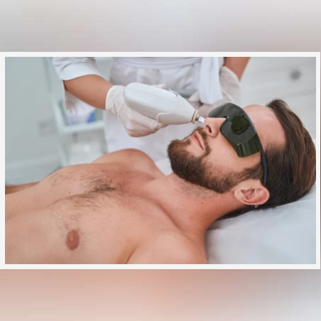 Лазерна епилация зона Нос /Мъже/