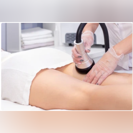 Ултразвукова кавитация с RF и вакуумтерапия на задни бедра