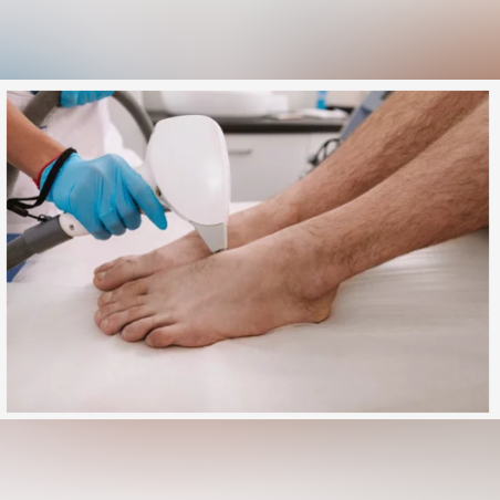 Лазерна епилация зона Ходила /Мъже/