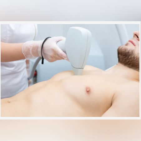 Лазерна епилация зона Гърди /Мъже/