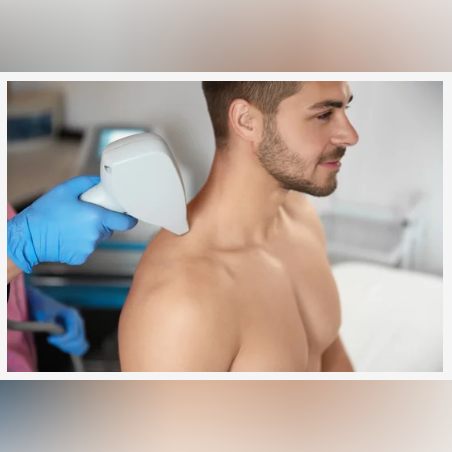 Лазерна епилация зона Рамене /Мъже/