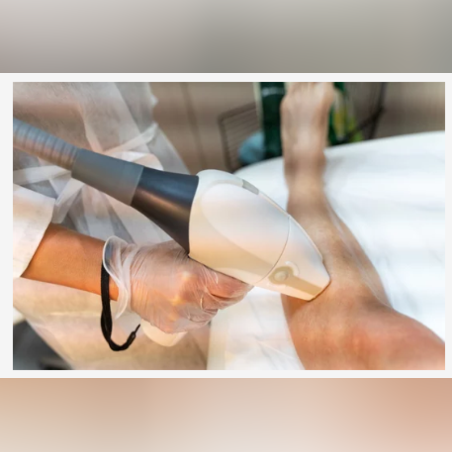 Лазерна епилация зона Подбедрици /Мъже/