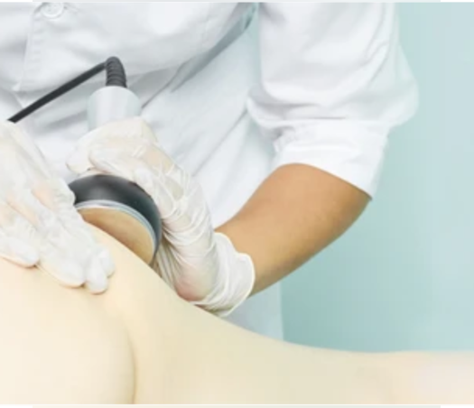 Ултразвукова кавитация с RF и вакуумтерапия на дупе