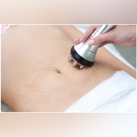 Ултразвукова кавитация с RF и вакуумтерапия на корем