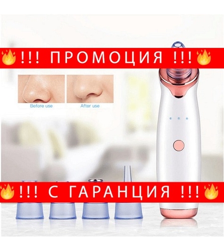 НЕМСКИ Вакуум уред за премахване на черни точки, Диамантено микродермабразио, USB кабел, 3W, Бял + ЛЕД ФЕНЕР