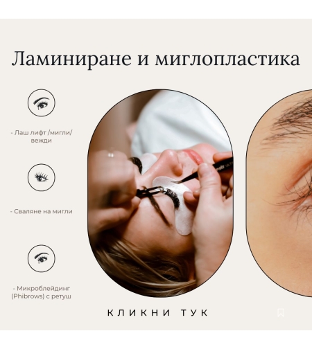 Миглопластика